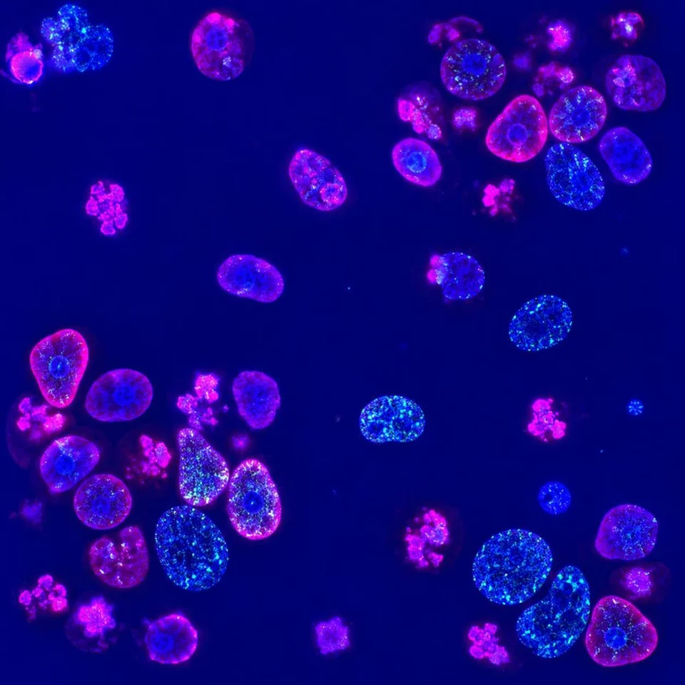 Fluorescent blue and magenta cells under microscopy